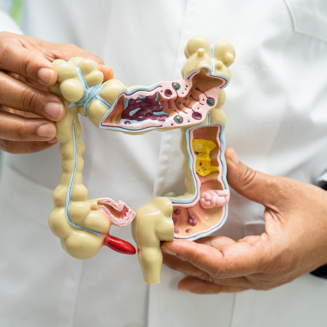 Bladder Cancer – Anchorage Project Access